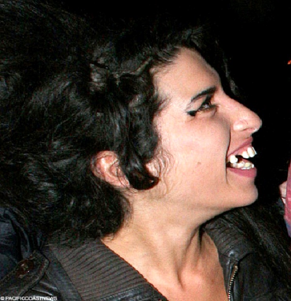 Amy Winehouse-Most Ugly Celebrities
