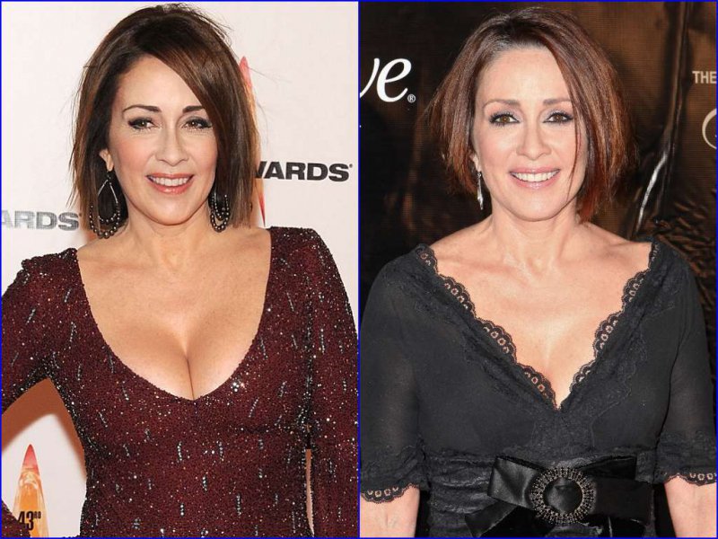 Patricia Heaton Before And After Breast Reduction Surgery-15 Celebrities Wh...