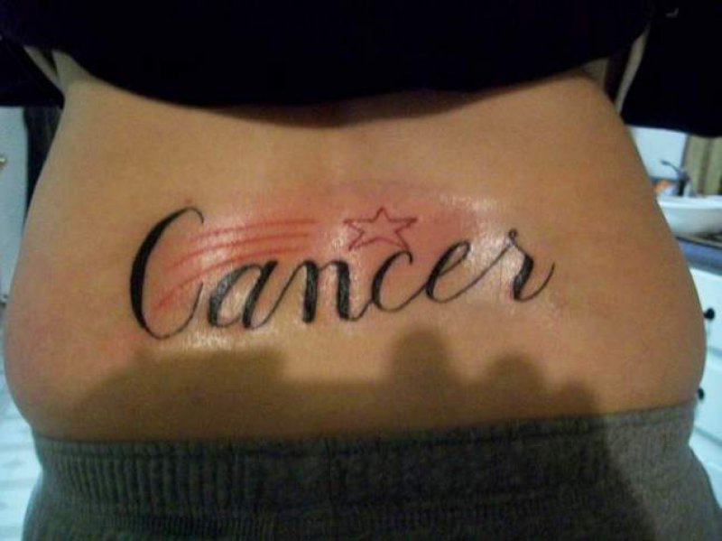 A Scar Left by Cancer-15 Tramp Stamps That Will Make You Feel Disgusted