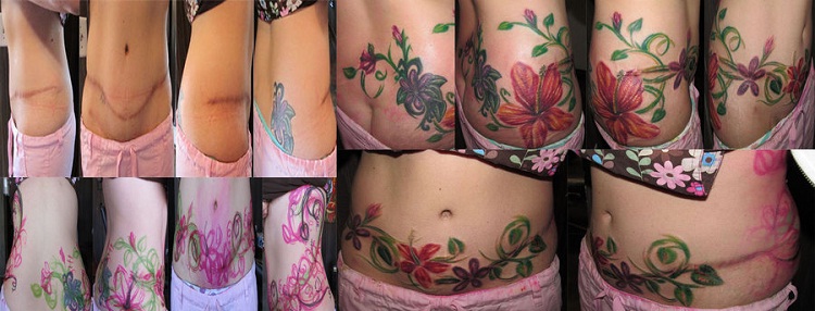 Growing Vine-Best Tattoos To Cover A Scar