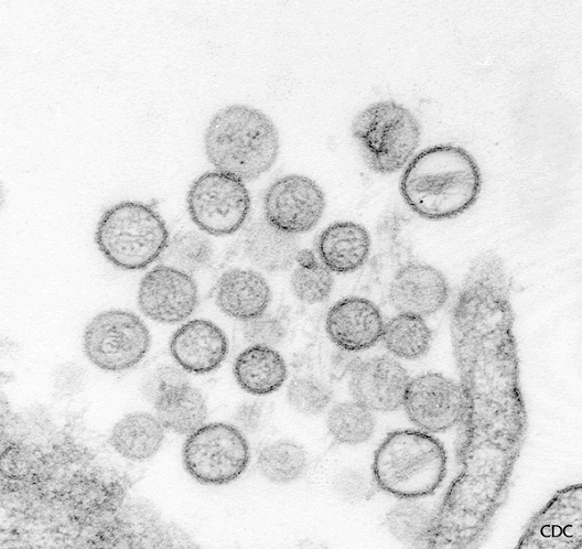 Hantavirus-Most Dangerous Viruses In The World Today