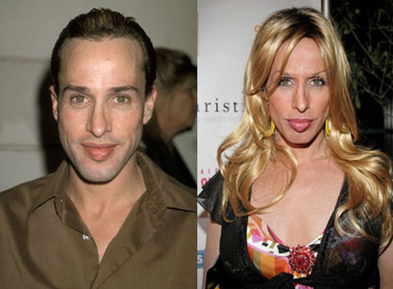 Celebrity before after transgender and 25 Celebrities