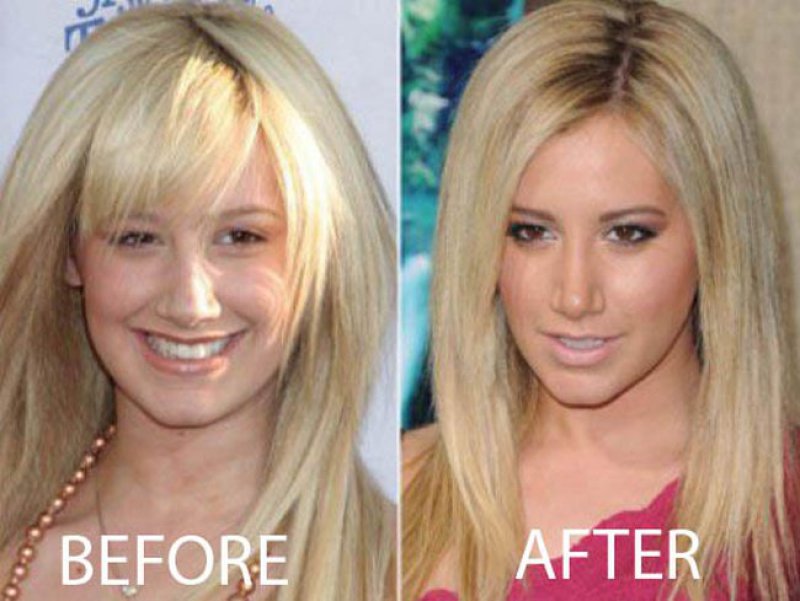 Ashley Tisdale-12 Celebrity Nose Jobs You Didn't Know About