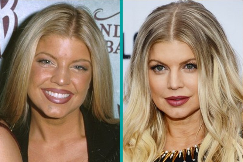 Fergie-12 Celebrity Nose Jobs You Didn't Know About