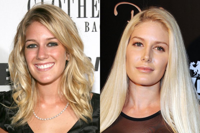 Heidi Montag-12 Celebrity Nose Jobs You Didn't Know About