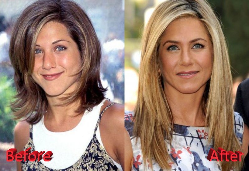 Jennifer Aniston-12 Celebrity Nose Jobs You Didn't Know About