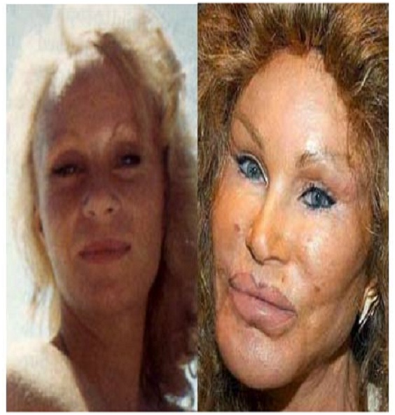 Jocelyn Wildenstein (Before & After)-Top 18 Celebs With Plastic Surgery