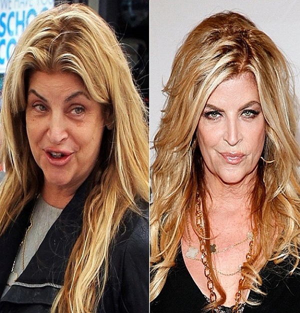 Kirstie Alley-15 Celebrities With And Without Makeup