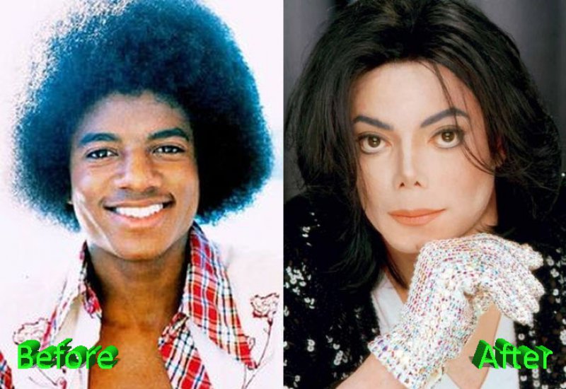 Michael Jackson-12 Celebrity Nose Jobs You Didn't Know About