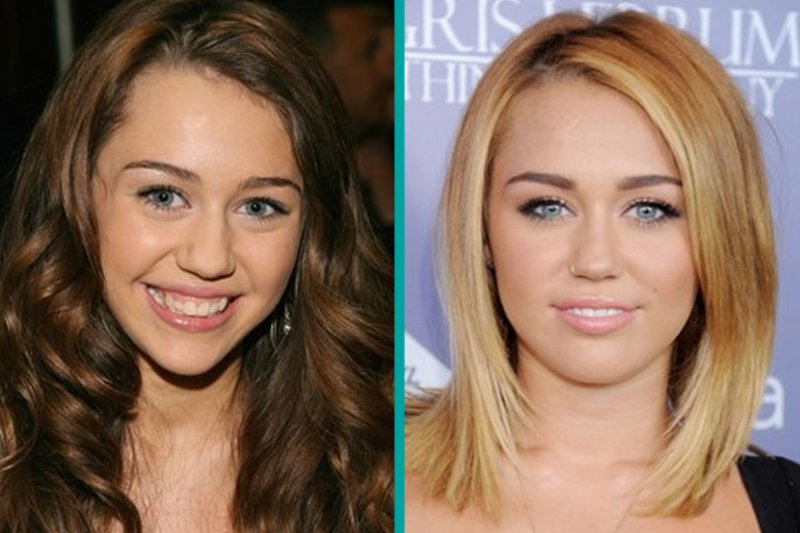 Miley Cyrus-12 Celebrity Nose Jobs You Didn't Know About