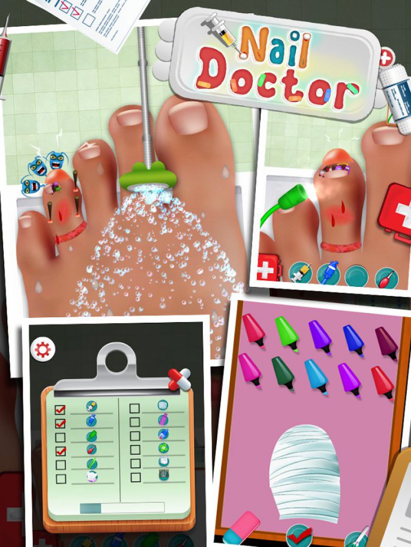 Nail Doctor-15 Best Surgery Games For IOS And Android