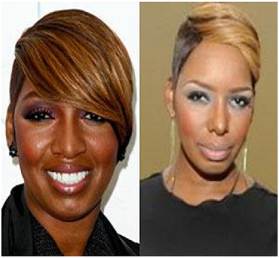 NeNe Leakes (Before & After)-Top 18 Celebs With Plastic Surgery