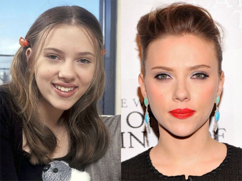 Scarlett Johansson-12 Celebrity Nose Jobs You Didn't Know About