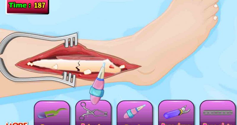 Tom Leg Surgery-15 Best Surgery Games For IOS And Android