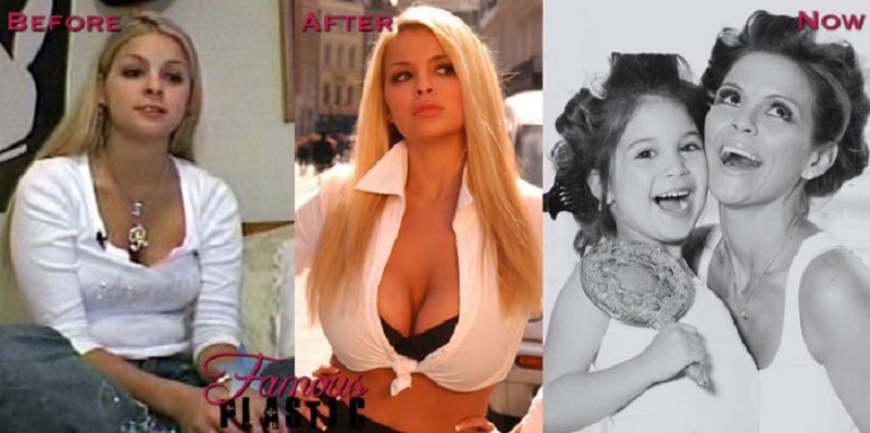 Sha Ross (Pamela Anderson)-15 People Who Had Plastic Surgery To Look Like Celebs