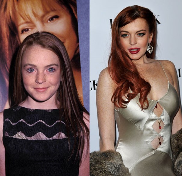 Lindsay Lohan-Top 18 Celebs With Plastic Surgery