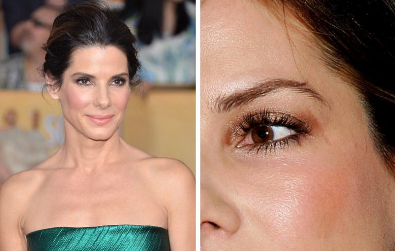 Sandra Bullock - Eye Scar-12 Celebrities With Scars And Deformities