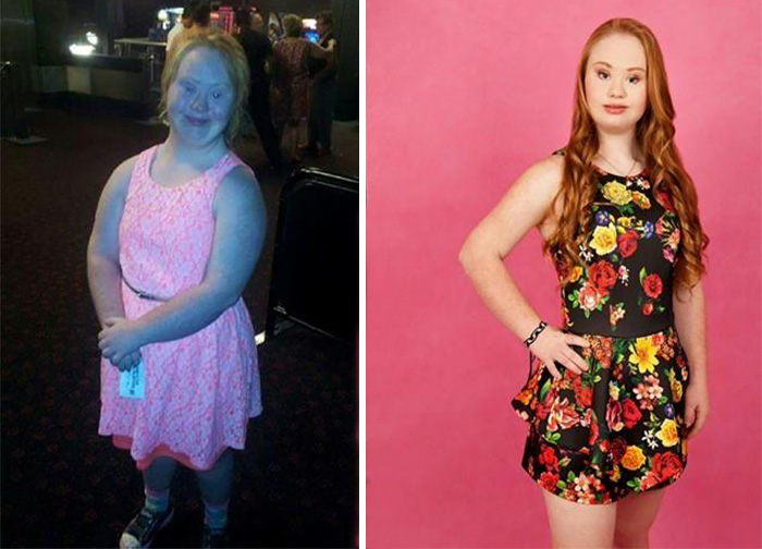 She is Fighting for a Better Cause-Meet Madeline, A Teen Model With Down Syndrome