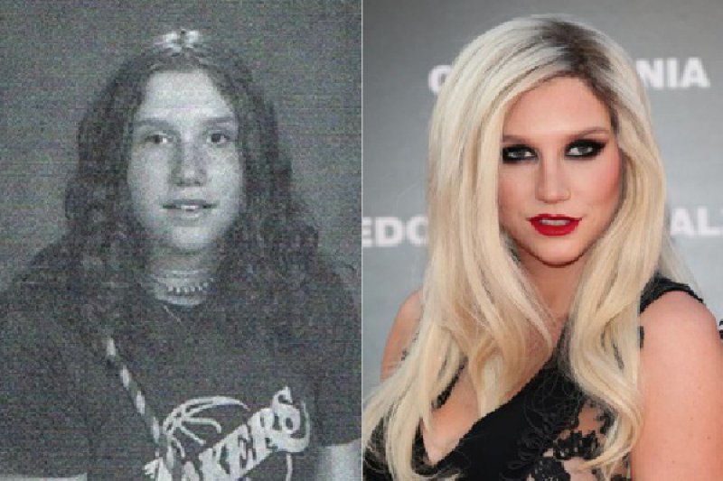 Kesha-12 Celebrities Who Looked Ugly When They Were Kids