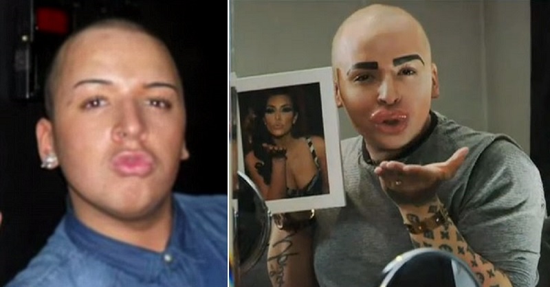 Jordan James Parke (Kim Kardashian Fan)-15 People Who Had Plastic Surgery To Look Like Celebs