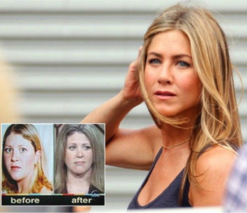 Kelly Chandler (Jennifer Aniston Fan)-15 People Who Had Plastic Surgery To Look Like Celebs