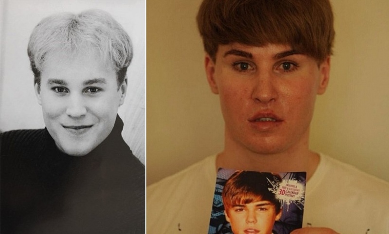 Toby Sheldon (Justin Bieber)-15 People Who Had Plastic Surgery To Look Like Celebs