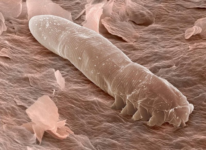 Your Skin and Eyelashes Are Home For Mites  -15 Disturbing Facts About Human Body That May Shock You