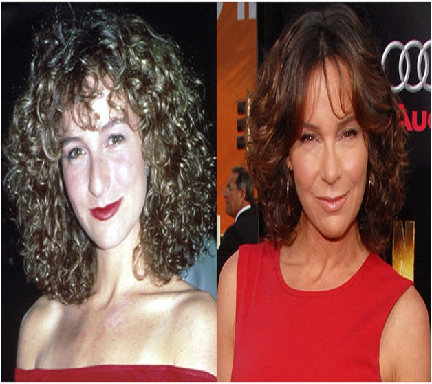 Jennifer Grey (Before & After)-Top 18 Celebs With Plastic Surgery