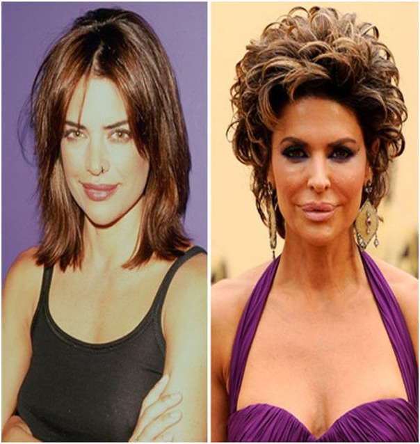 Lisa Rinna (Before & After)-Top 18 Celebs With Plastic Surgery