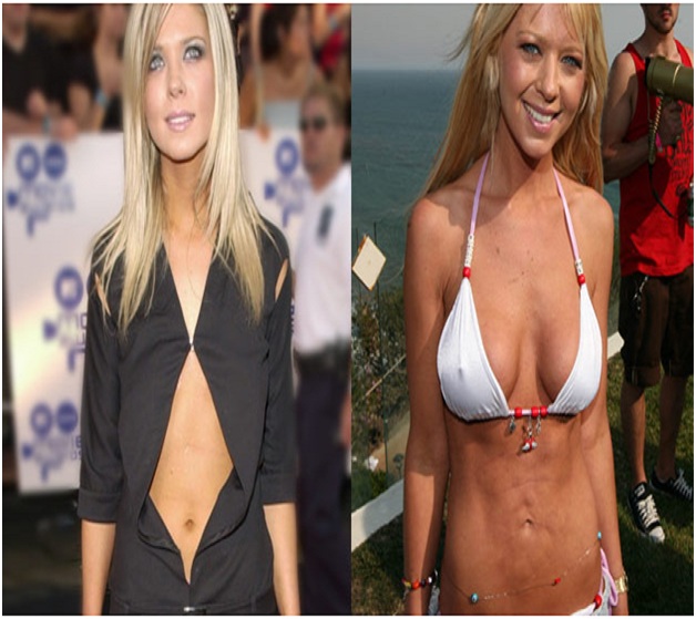 Tara Reid (Before & After)-Top 18 Celebs With Plastic Surgery